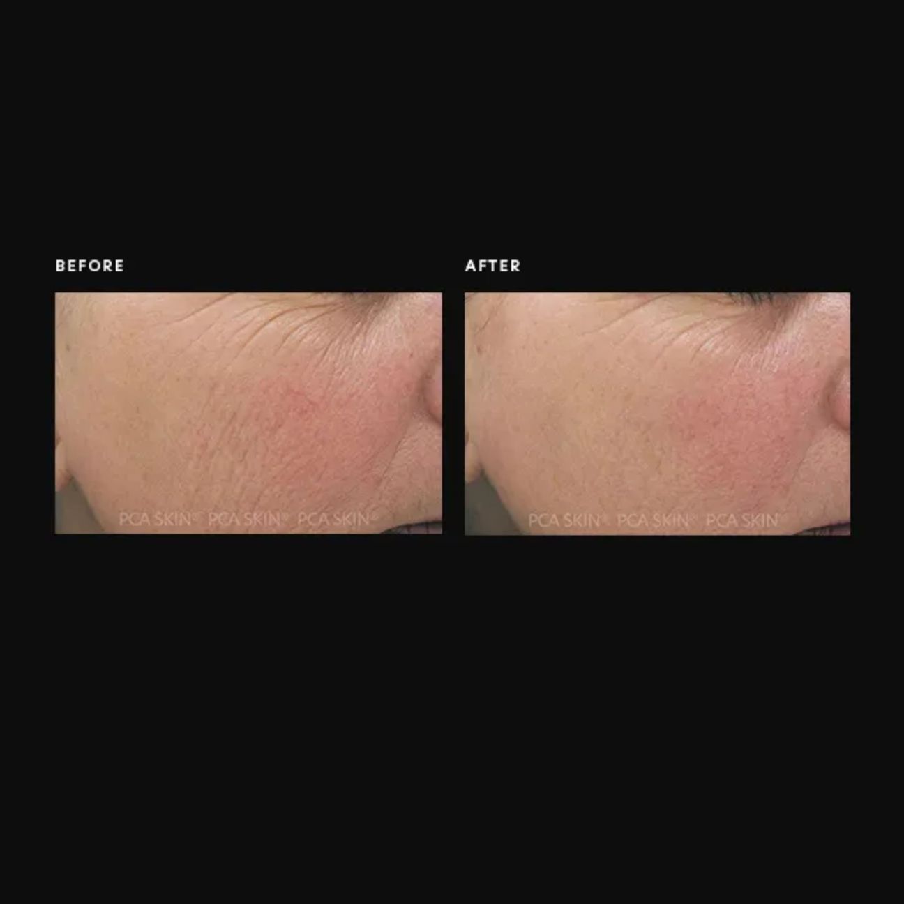 C-Quench® Antioxidant Serum