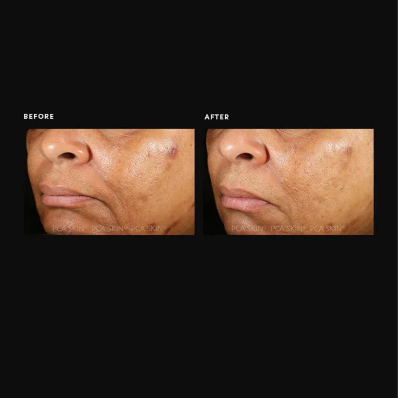 Pigment Gel® Pro