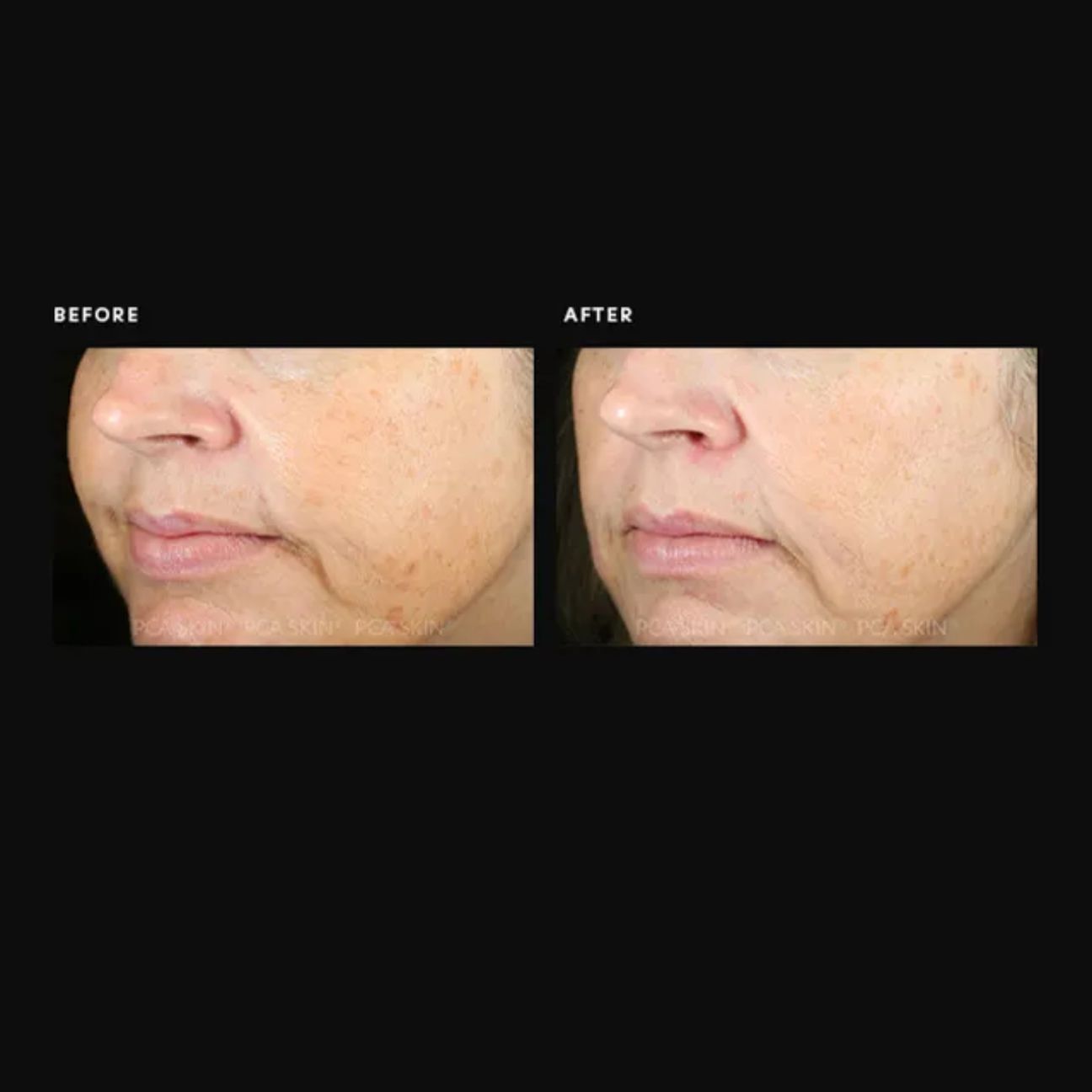 Pigment Gel® Pro