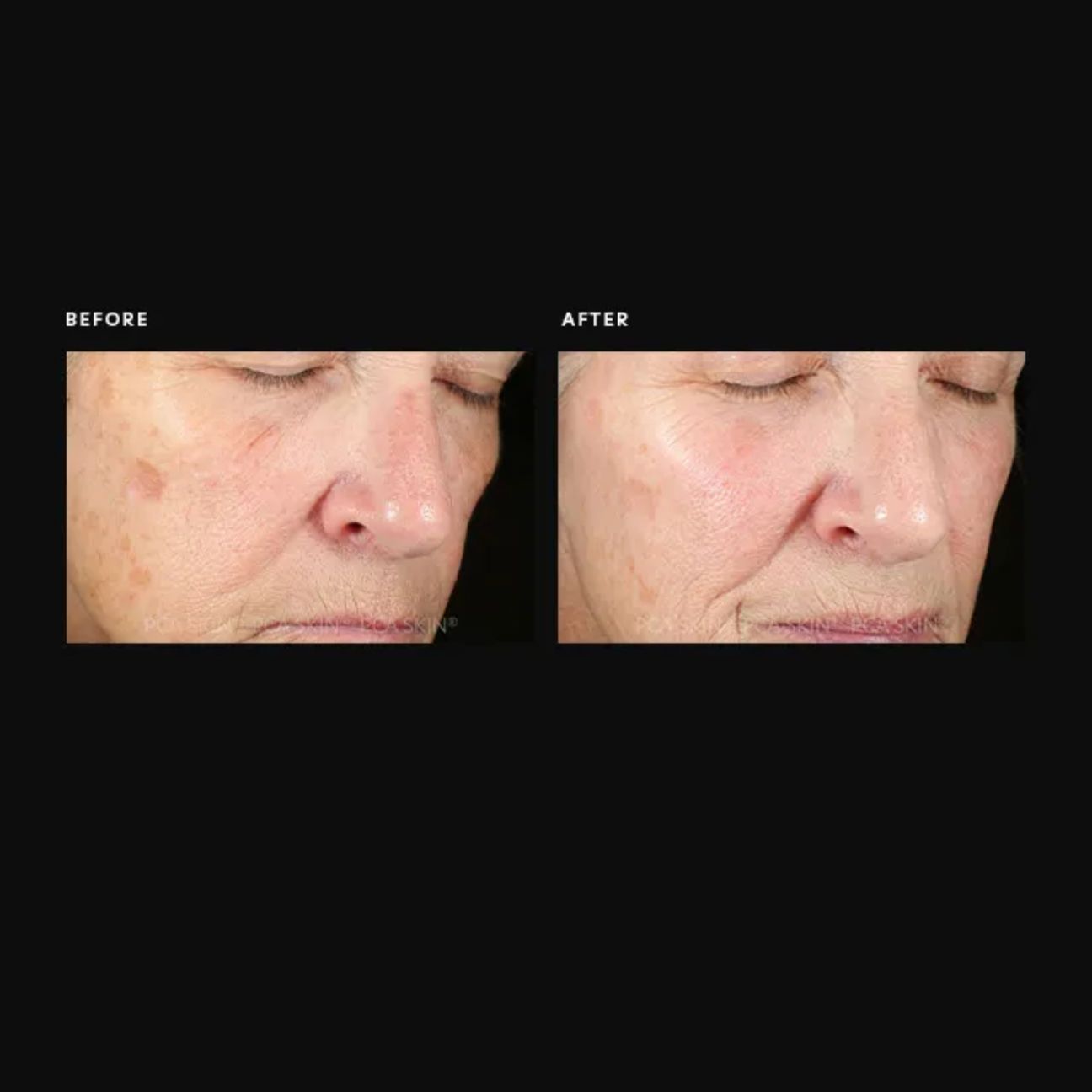 Pigment Gel® Pro